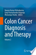 Colon Cancer Diagnosis and Therapy Book