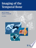 Imaging Of The Temporal Bone