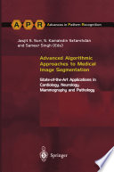 Advanced Algorithmic Approaches to Medical Image Segmentation Book