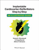 Implantable Cardioverter   Defibrillators Step by Step