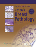 Rosen s Breast Pathology