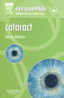 Cataract Book
