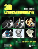 3D echocardiography /