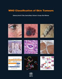 WHO Classification of Skin Tumours Book