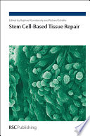 Stem Cell based Tissue Repair