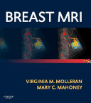 Breast MRI E-Book