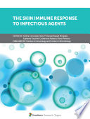 The Skin Immune Response to Infectious Agents