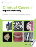 Clinical Cases in Implant Dentistry Book PDF