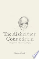 The Alzheimer Conundrum Book