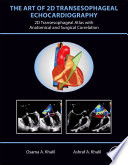 The Art of 2D Transesophageal Echocardiography