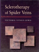 SCLEROTHERAPY OF SPIDER VEINS