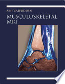 Musculoskeletal MRI Book