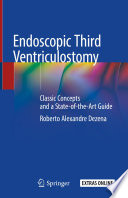 Endoscopic Third Ventriculostomy Classic Concepts and a State-of-the-Art Guide /