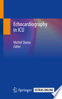 Echocardiography in ICU