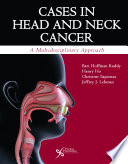 Cases in Head and Neck Cancer Book