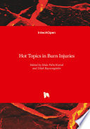 Hot Topics in Burn Injuries Book