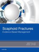 Scaphoid Fractures [Pdf/ePub] eBook