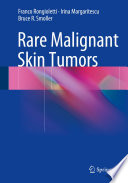Rare Malignant Skin Tumors Book