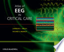 Atlas of EEG in Critical Care Book