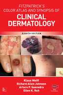 Fitzpatrick s Color Atlas and Synopsis of Clinical Dermatology  Eighth Edition