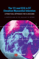 The 12 Lead ECG in ST Elevation Myocardial Infarction Book PDF