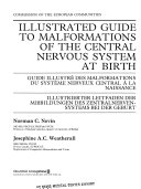 Illustrated Guide to Malformations of the Central Nervous System at Birth