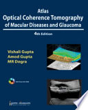 Atlas Optical Coherence Tomography of Macular Diseases and Glaucoma Book