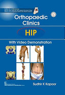 Orthopedic Clinics: Hip