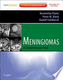 Meningiomas E Book Book