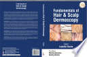 Fundamentals of Hair and Scalp Dermoscopy