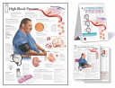 Understanding Hypertension Study Set