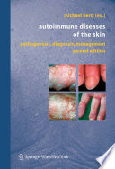 Autoimmune Diseases of the Skin Book