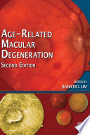 Age Related Macular Degeneration Book