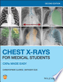 Chest X Rays For Medical Students