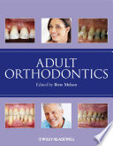 Adult Orthodontics Book