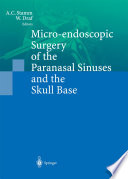Micro endoscopic Surgery of the Paranasal Sinuses and the Skull Base