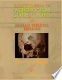 Identification of Pathological Conditions in Human Skeletal Remains Book