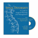Spinal Deformity Book