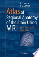 Atlas of Regional Anatomy of the Brain Using MRI Book