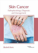 Skin Cancer  Pathophysiology  Diagnosis and Management
