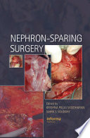 Nephron Sparing Surgery Book