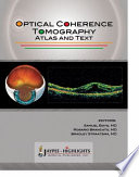 Optical Coherence Tomography Book