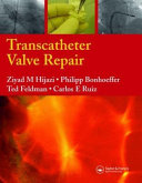 Read Pdf Transcatheter Valve Repair