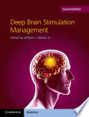 Deep Brain Stimulation Management Book