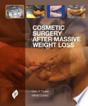 Cosmetic Surgery After Massive Weight Loss Book