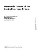 Metastatic Tumors of the Central Nervous System