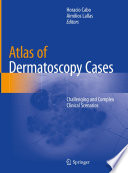 Atlas of Dermatoscopy Cases Challenging and Complex Clinical Scenarios /