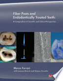 Fiber Posts and Endodontically Treated Teeth Book