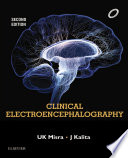Clinical Electroencephalography E Book