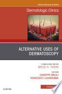 Alternative Uses of Dermatoscopy  An Issue of Dermatologic Clinics E Book Book